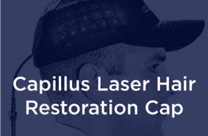 capillus laser
